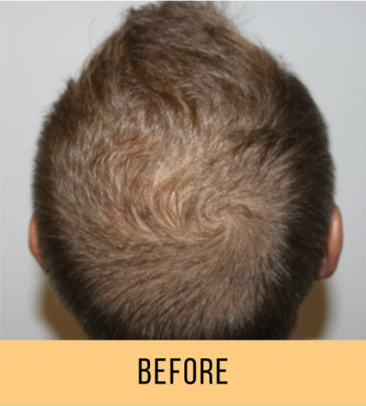 Keravive Scalp & Hair Treatment
